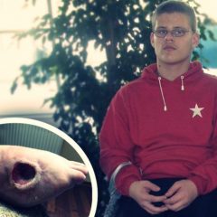 Pomóżmy Sebastianowi- trwa zbiórka na Siepomaga